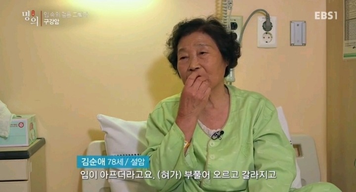 구강암 환자들은 혀를 잘라야한다는 사실에 큰 심리적 충격을 받는다.jpg | 인스티즈