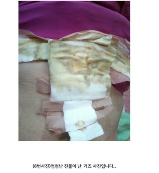 아래 글 사이코패스의사 성형 피해자들 사진 (심약자 주의!) | 인스티즈