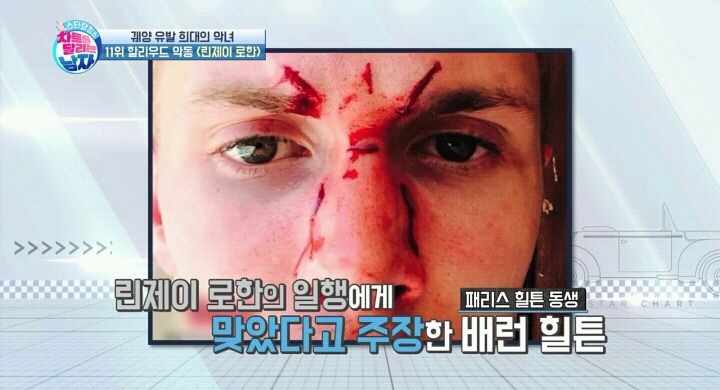 전자발찌까지 찬 린제이로한.jpg | 인스티즈