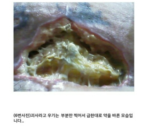 아래 글 사이코패스의사 성형 피해자들 사진 (심약자 주의!) | 인스티즈