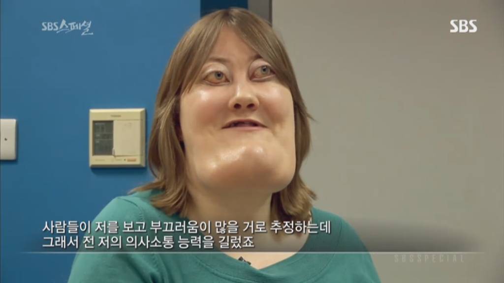 기형적 턱을 가진 여자 비키 라이트가 성형수술을 하지 않는 이유 | 인스티즈