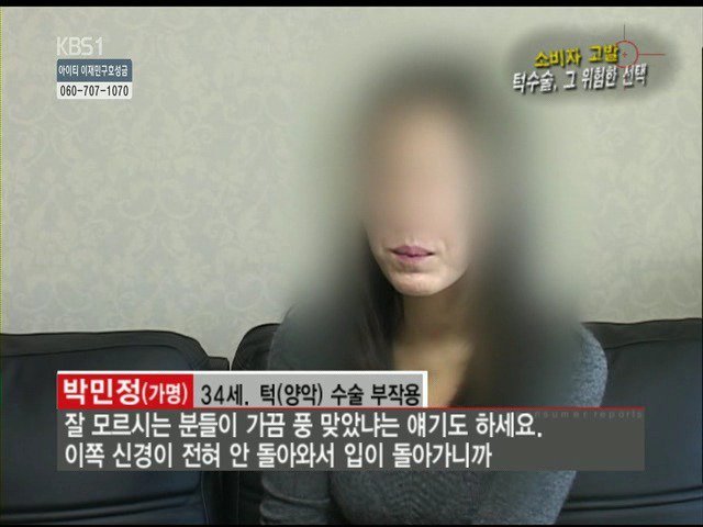 성형외과 종사자들이 말하는 부작용 위험높은 수술 쓰리톱 (혐오주의) | 인스티즈