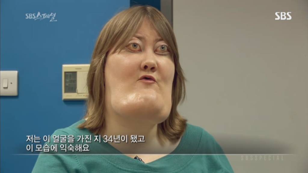 기형적 턱을 가진 여자 비키 라이트가 성형수술을 하지 않는 이유 | 인스티즈