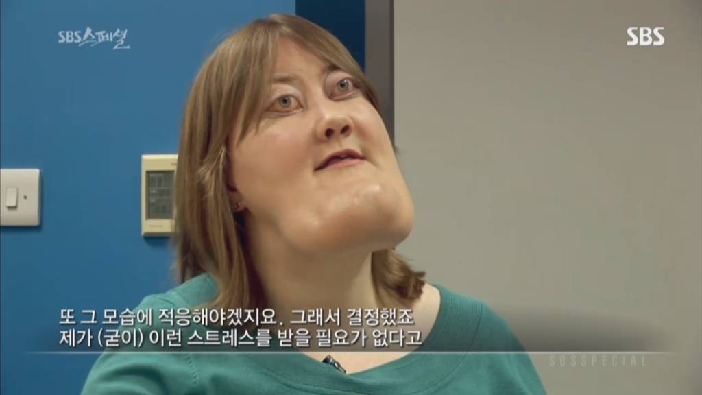 기형적 턱을 가진 여자 비키 라이트가 성형수술을 하지 않는 이유 | 인스티즈