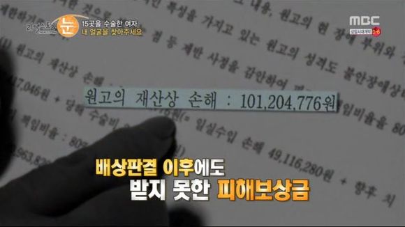 [리얼스토리눈] 15곳을 수술한 여자 내 얼굴을 찾아주세요 (성형수술 부작용) | 인스티즈