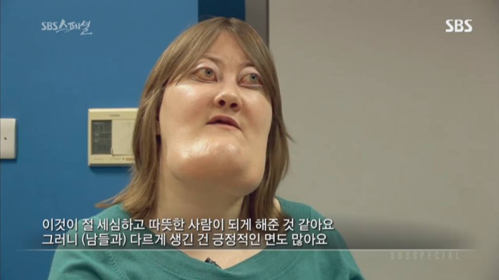 기형적 턱을 가진 여자 비키 라이트가 성형수술을 하지 않는 이유 | 인스티즈