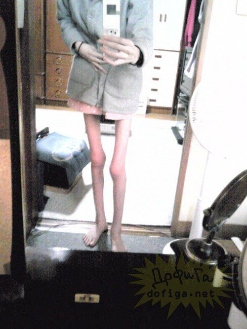 일본의 거식증녀 | 인스티즈