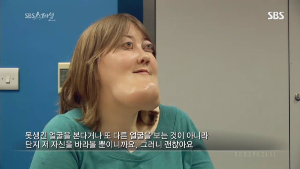 기형적 턱을 가진 여자 비키 라이트가 성형수술을 하지 않는 이유 | 인스티즈