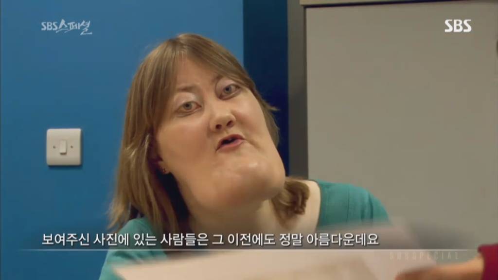 기형적 턱을 가진 여자 비키 라이트가 성형수술을 하지 않는 이유 | 인스티즈