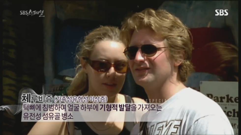 기형적 턱을 가진 여자 비키 라이트가 성형수술을 하지 않는 이유 | 인스티즈