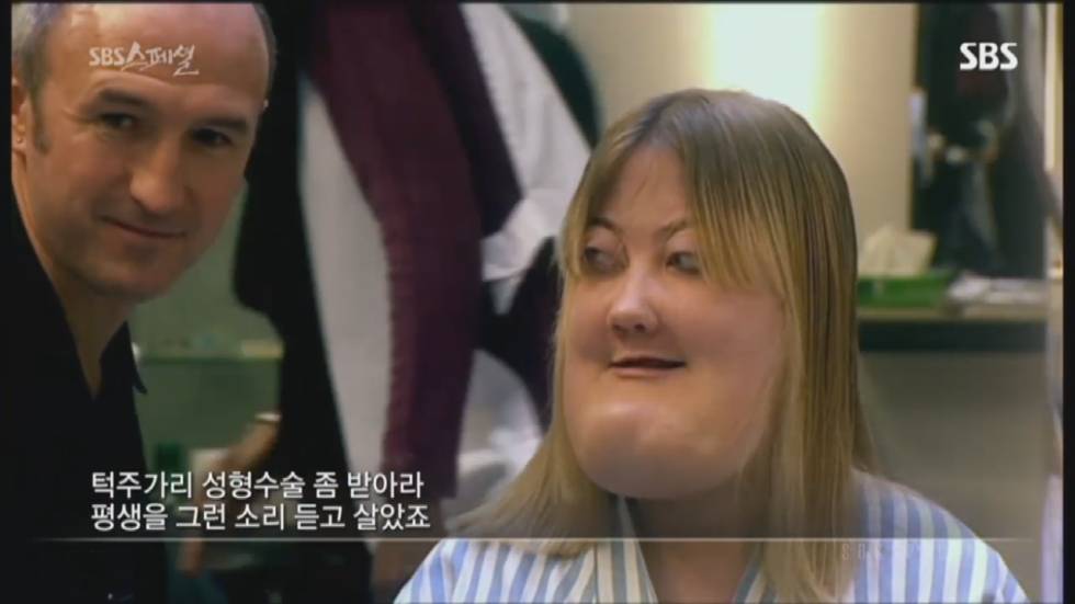 기형적 턱을 가진 여자 비키 라이트가 성형수술을 하지 않는 이유 | 인스티즈