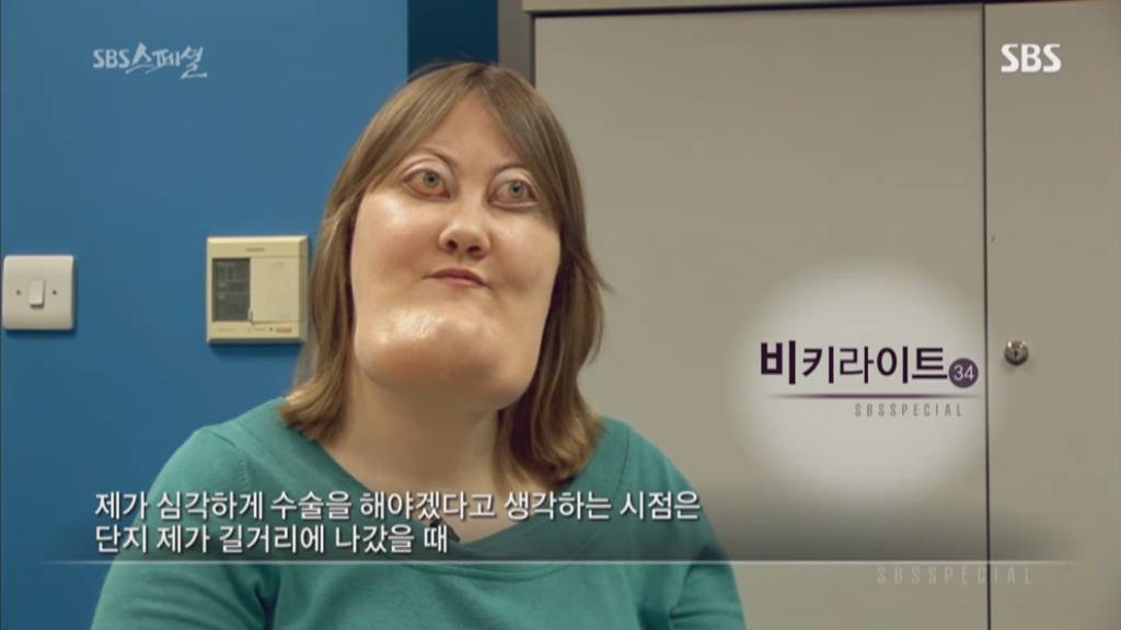 기형적 턱을 가진 여자 비키 라이트가 성형수술을 하지 않는 이유 | 인스티즈