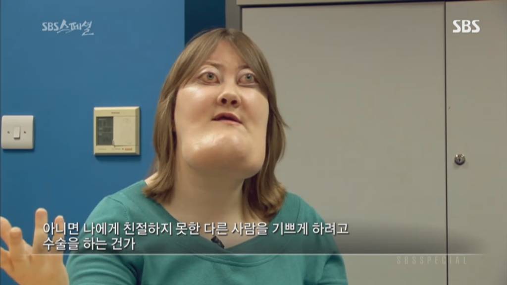 기형적 턱을 가진 여자 비키 라이트가 성형수술을 하지 않는 이유 | 인스티즈