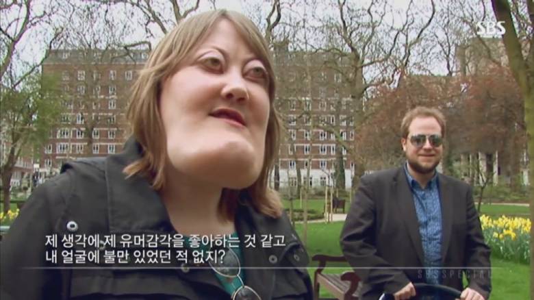 기형적 턱을 가진 여자 비키 라이트가 성형수술을 하지 않는 이유 | 인스티즈