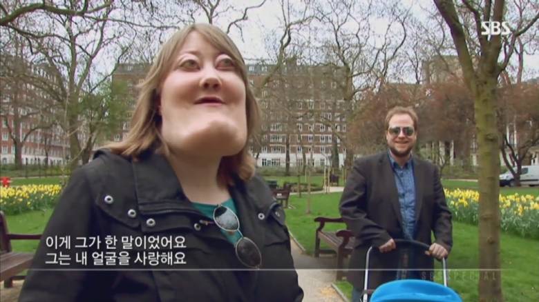 기형적 턱을 가진 여자 비키 라이트가 성형수술을 하지 않는 이유 | 인스티즈