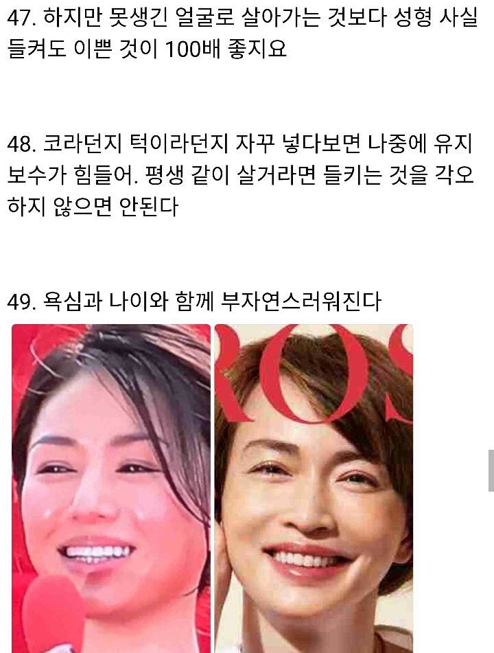 일본여자들의 성형 얘기 (뒤로갈수록 주의) | 인스티즈