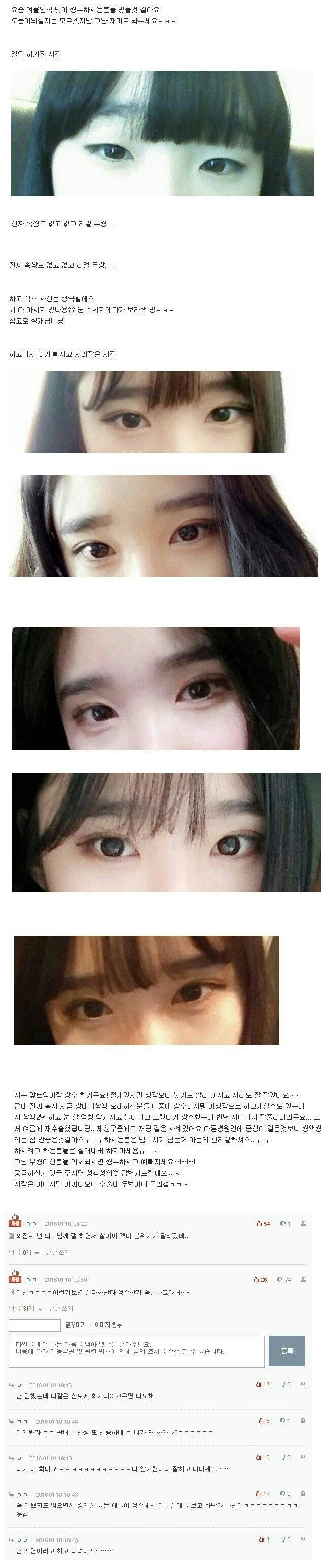 대박난 쌍꺼플수술녀 | 인스티즈