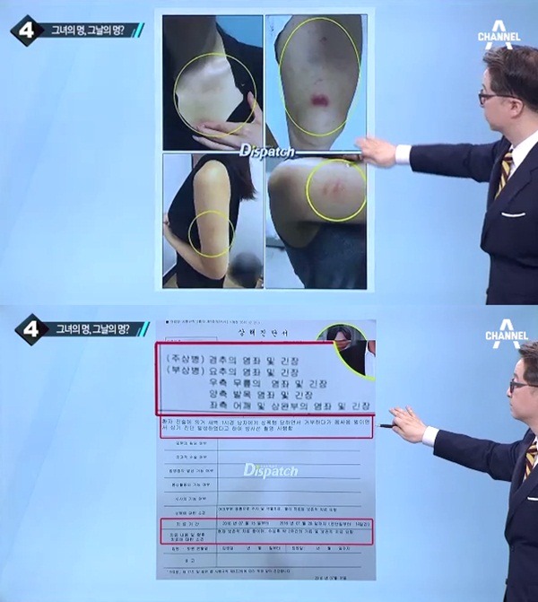 다시 보는 이진욱 고소인 상해진단서.jpg | 인스티즈