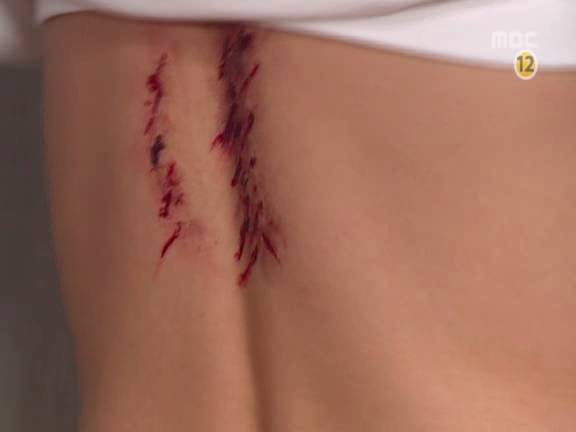 [거침없이하이킥] 민호보다 더 크게 다쳤는데 사람들이 몰라줘서 억울한 윤호.jpg | 인스티즈