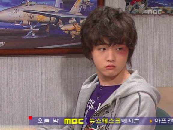 [거침없이하이킥] 민호보다 더 크게 다쳤는데 사람들이 몰라줘서 억울한 윤호.jpg | 인스티즈