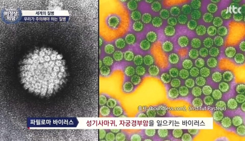 [비정상회담] 여성들이 자궁경부암에 걸리는 원인 | 인스티즈
