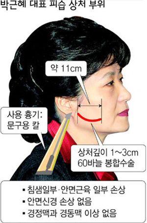 다시보는 박근혜 칼빵맞는 장면.gif | 인스티즈
