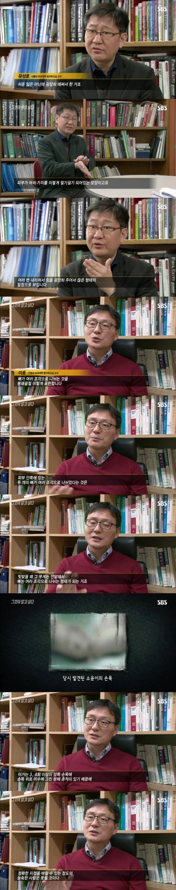 스압주의)그알 레전드 1탄-사라진 손목.jpg | 인스티즈