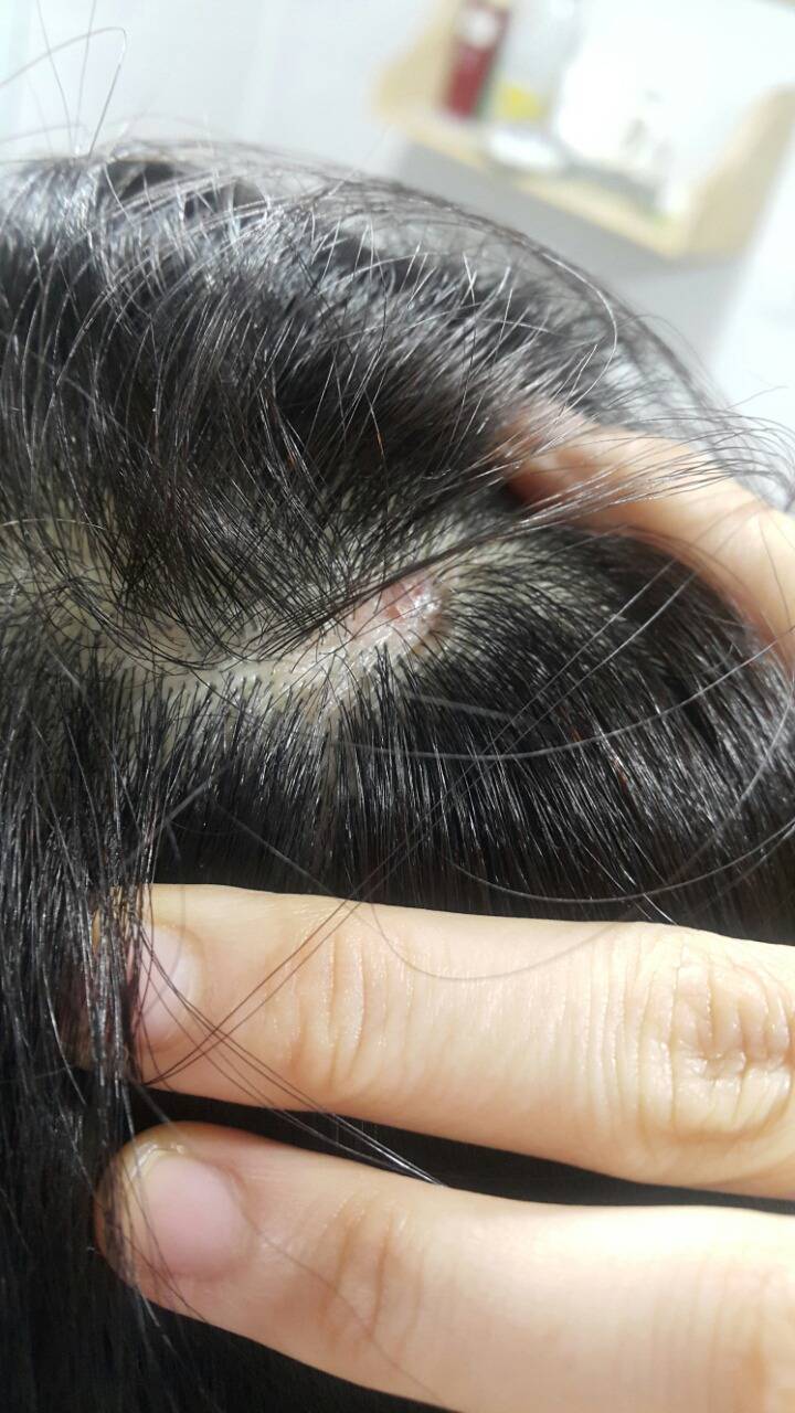 나는 데이트폭력을 당한 피해자였다.10번을 신고했고 10번다 나는 벗어나지 못했다. 죽기싫어서 계속 맞아야 했다.6 | 인스티즈