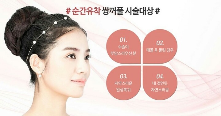 여자들 안해도 충분히 이쁜데 하는 수술중하나 | 인스티즈