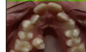 교정의 위엄.gif | 인스티즈