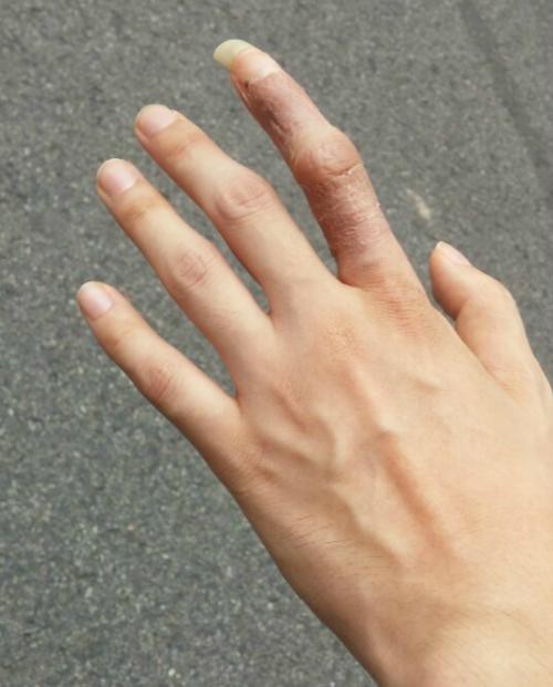 군의관의 욕설 | 인스티즈