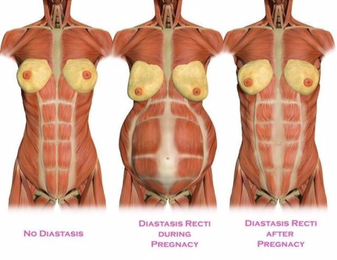 출산 후 몸이 회복되기가 어려운 이유 | 인스티즈