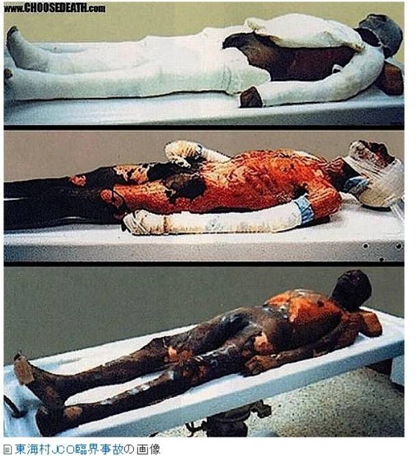 방사능의 무서움2 (시룸오사진 주의) | 인스티즈