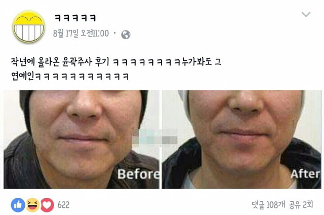 하관이 너무나도 연예인.jpg | 인스티즈