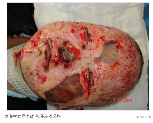 방사능의 무서움2 (시룸오사진 주의) | 인스티즈