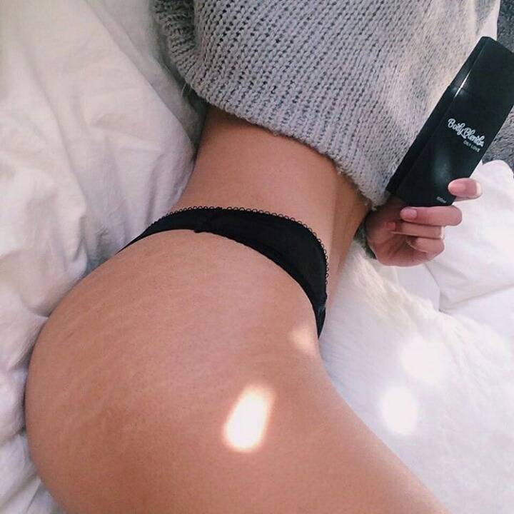 피부 튼살로 고민이 많은 여시들이 봐줬으면 하는 글 | 인스티즈