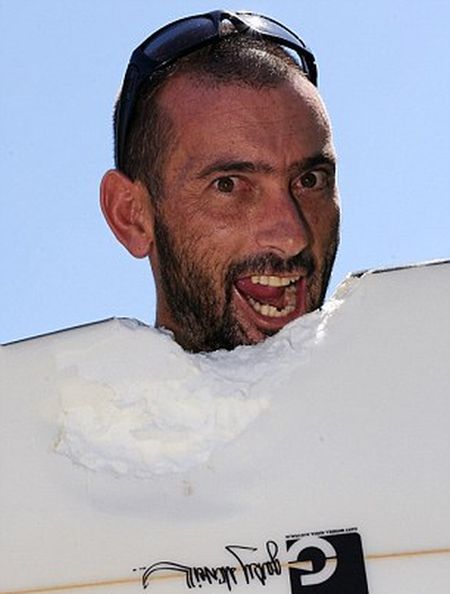 상어한테 물렸다 살아난 남자 | 인스티즈