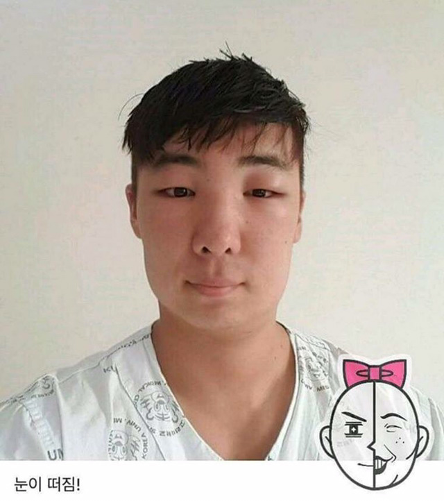 염색약 부작용 ㅎㄷㄷ(혐오주의) | 인스티즈