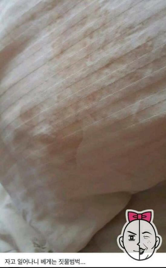 염색약 부작용 ㅎㄷㄷ(혐오주의) | 인스티즈