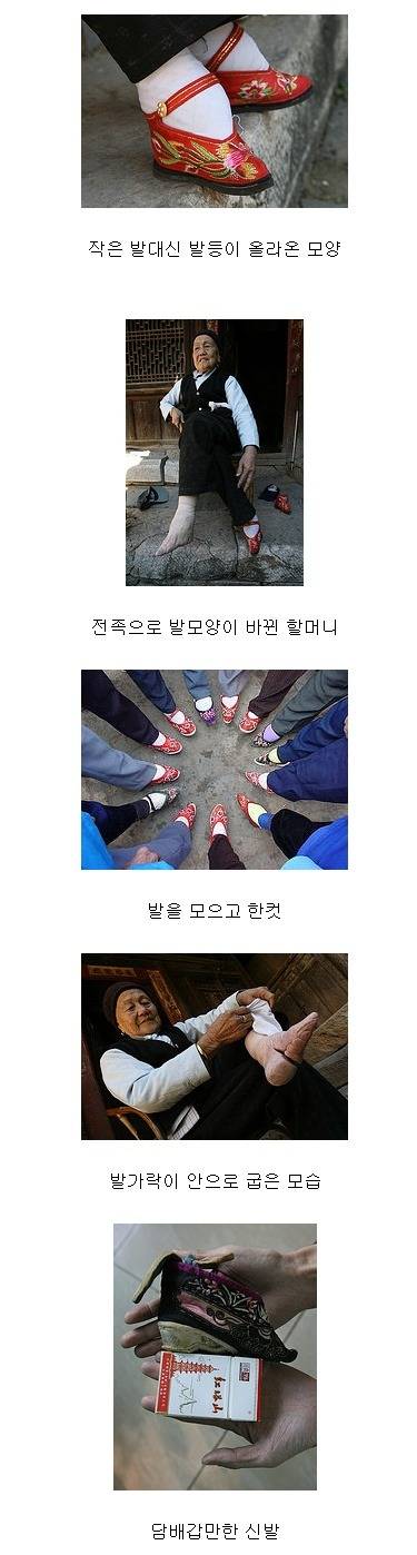 여자를 기형으로 만드는 세계 풍습들 | 인스티즈