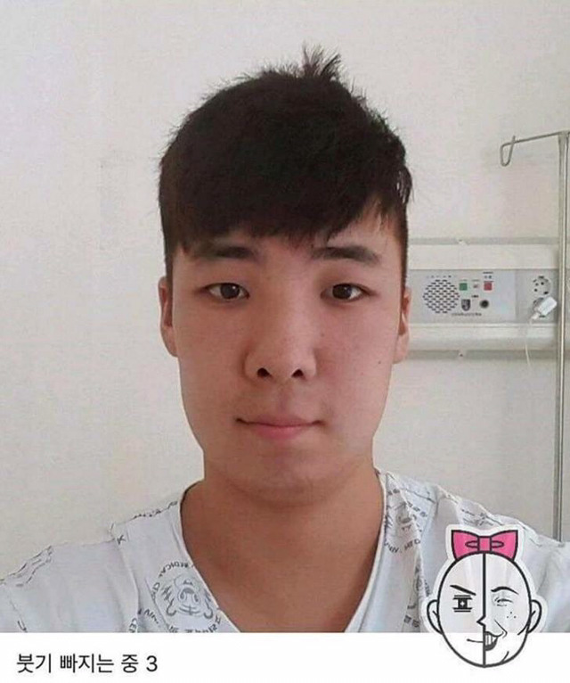 염색약 부작용 ㅎㄷㄷ(혐오주의) | 인스티즈