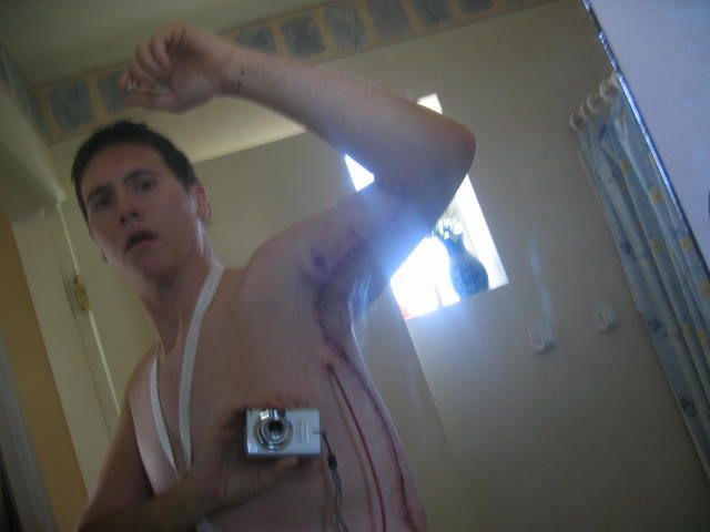 믿을 수 없는 살빼기 | 인스티즈