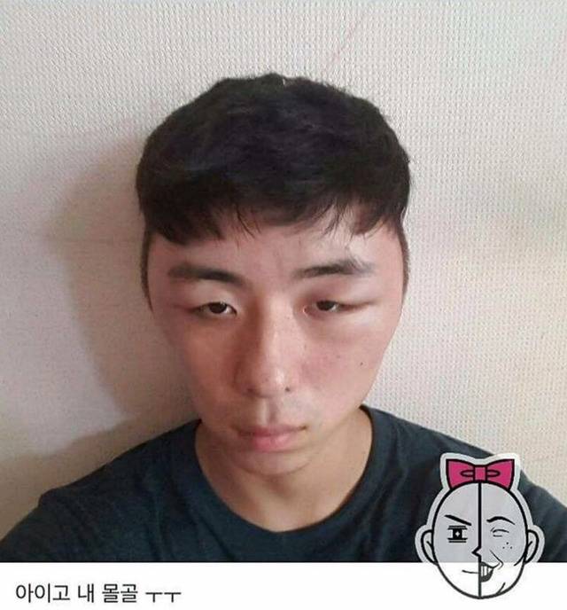 염색약 부작용 ㅎㄷㄷ(혐오주의) | 인스티즈