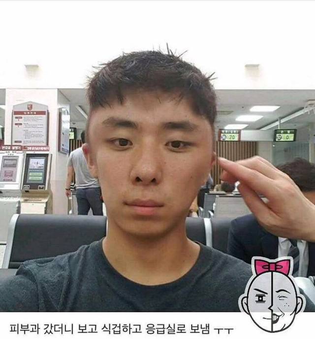 염색약 부작용 ㅎㄷㄷ(혐오주의) | 인스티즈