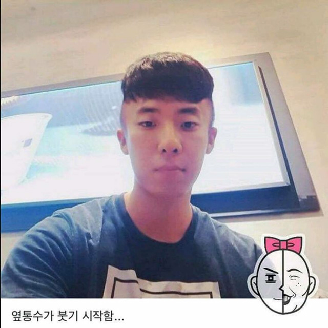 염색약 부작용 ㅎㄷㄷ(혐오주의) | 인스티즈