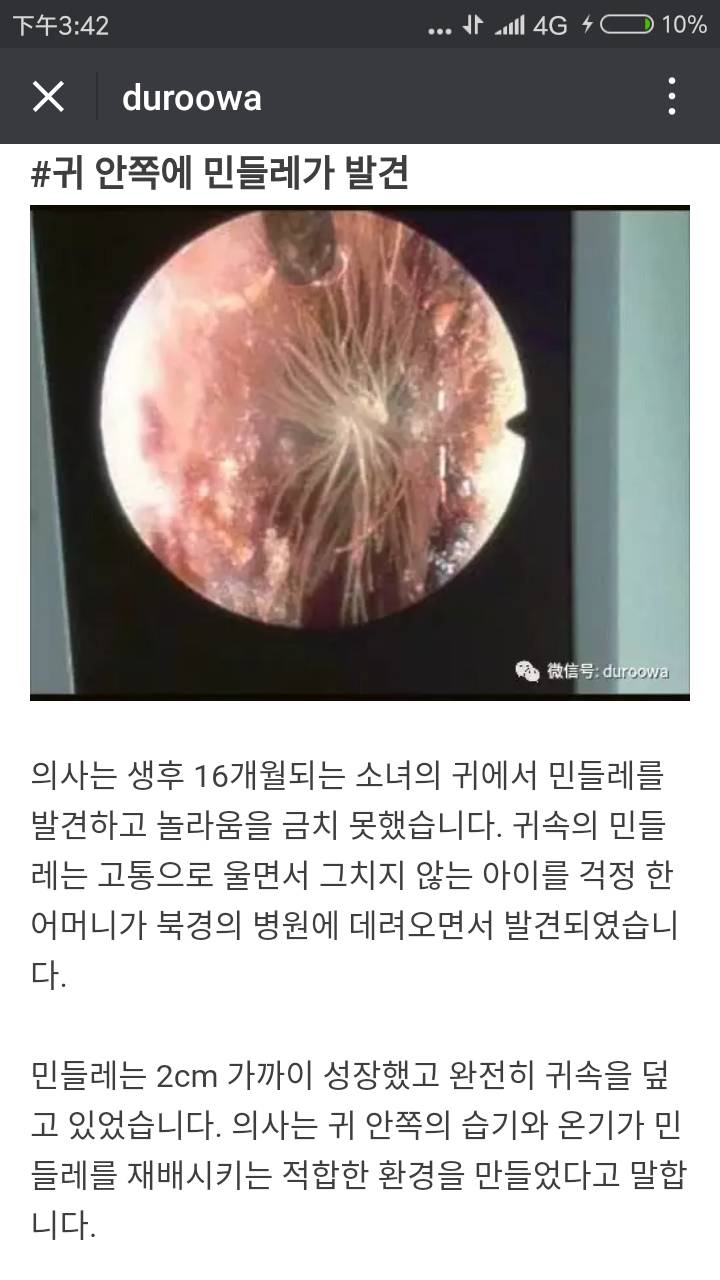 몸에서 나온 생명체들 (혐오주의) | 인스티즈