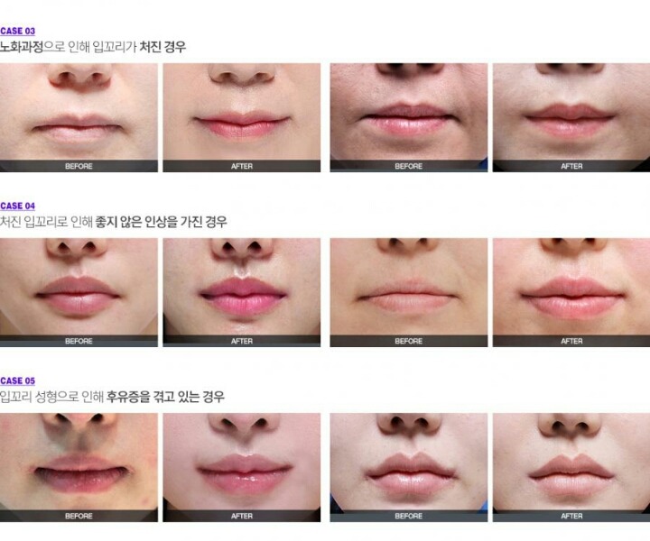 표정이 무뚝뚝하다는 소리를 많이 듣는 이유중 하나 | 인스티즈