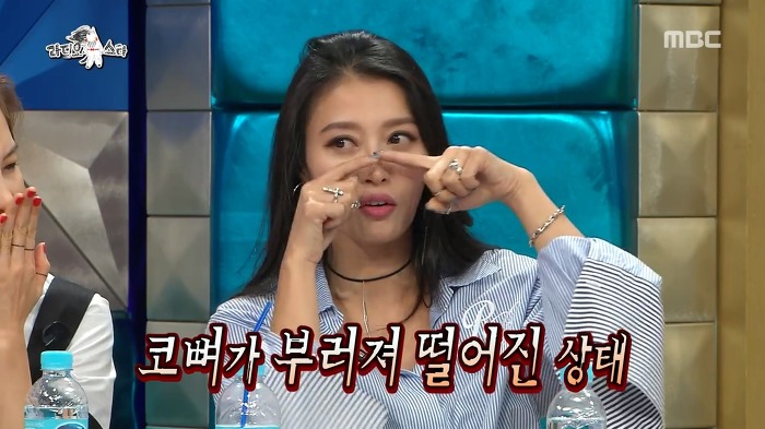 황보가 부러진 코뼈를 방치하는 이유.jpg | 인스티즈