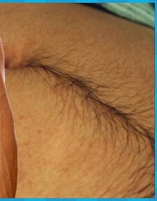 올여름이 오기전에 미리 블라질리언 왁싱을 알아봅시다.jpg | 인스티즈