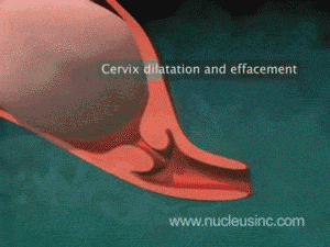 출산의 고통..gif | 인스티즈